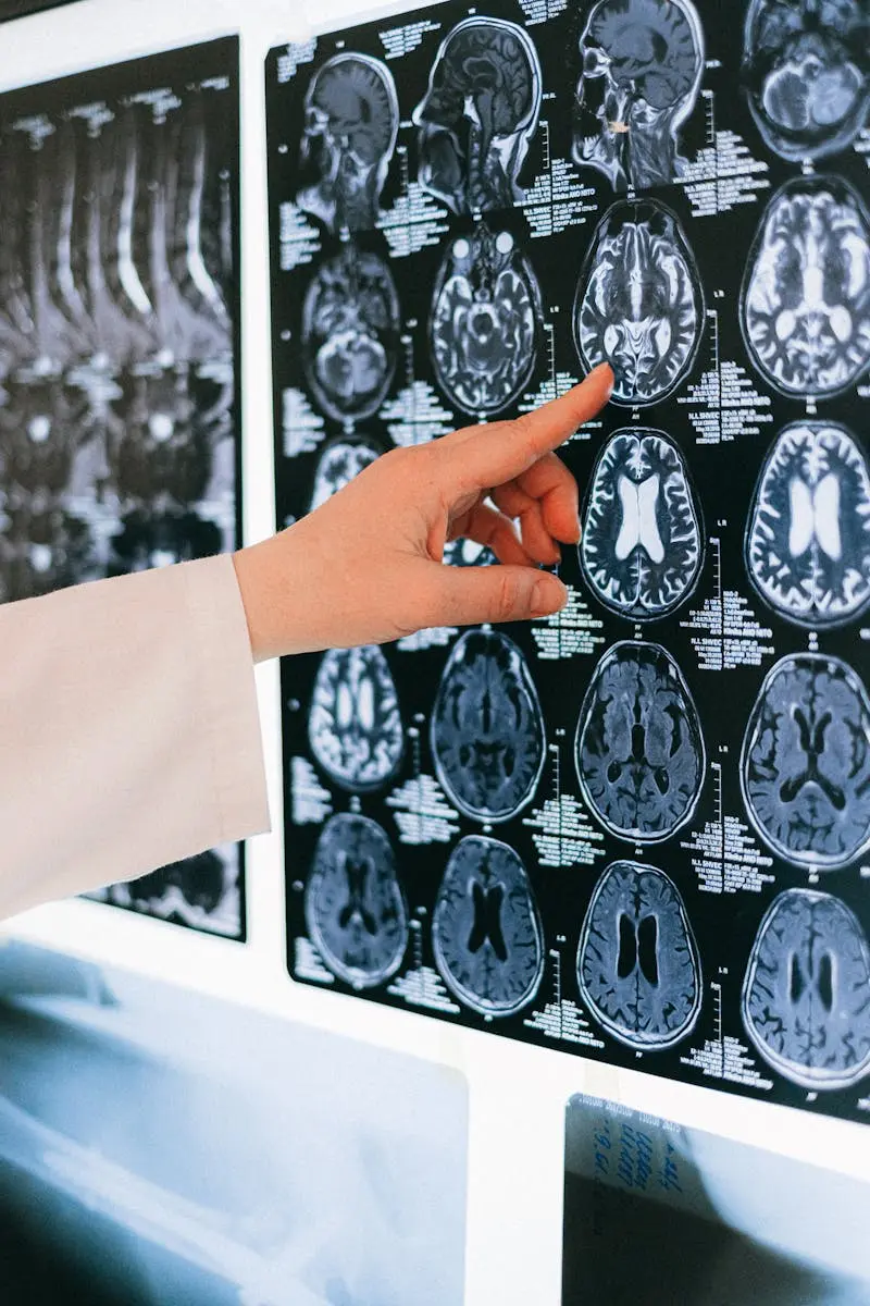CT-Scan